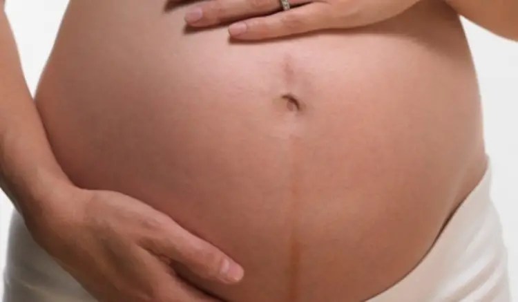 how to remove pregnancy dark line