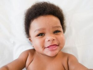 How To Improve Baby Skin Color Naturally - 8 Helpful Tips